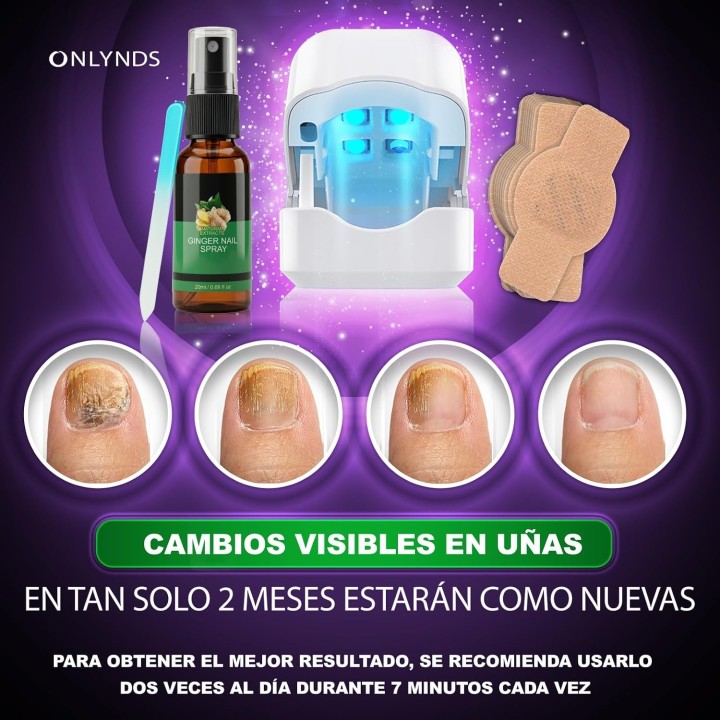 Onlynds Dispositivo Láser Antihongos Uñas Pies 460nm + Aceite Jengibre + Parches + Lima